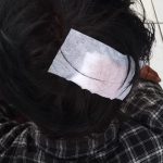 Polisi Diminta Segera Tangkap Pelaku Pengeroyokan Nurul Saprudin CYMERA_20180907_191411.jpg