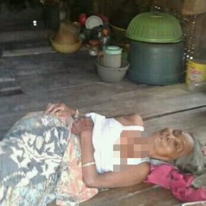 Memprihatinkan, Nenek Tua dan Anaknya yang Alami Gangguan Jiwa Butuh Perhatian Pemerintah