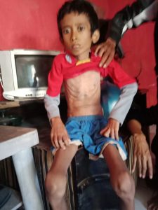 Memprihatinkan, Satu Keluarga Menderita Penyakit Paru Paru, Butuh Perhatian Pemerintah
