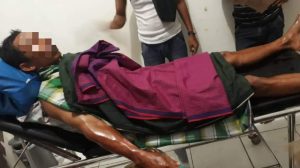 Tabung Gas Meledak Saat Hajatan, Tiga Orang Alami Luka Bakar