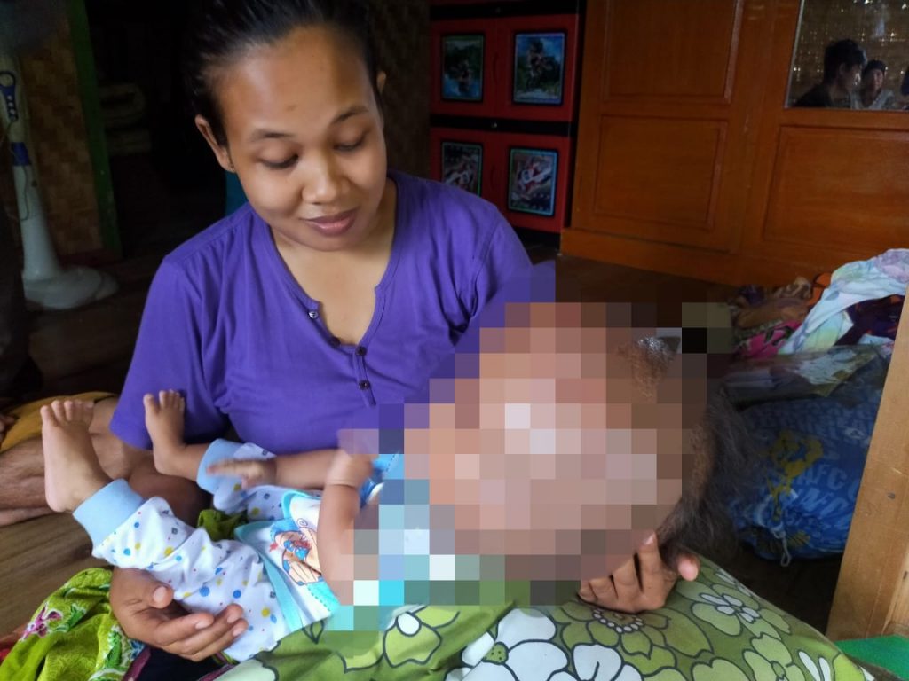 Miris Bayi 10 Bulan Derita Penyakit Hidrosefalus, Keluarga Tak Mampu Untuk Mengobatinya
