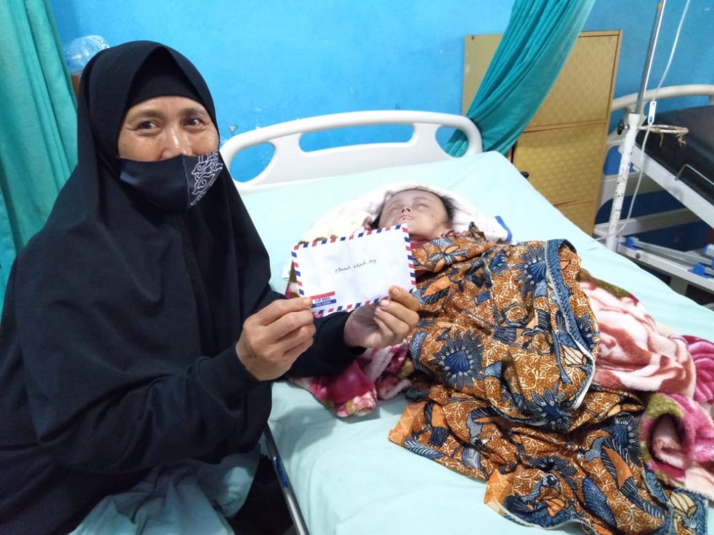 Sri Julia, Penderita Hidrosefalus dari Bojong kini ditangani Tim Medis