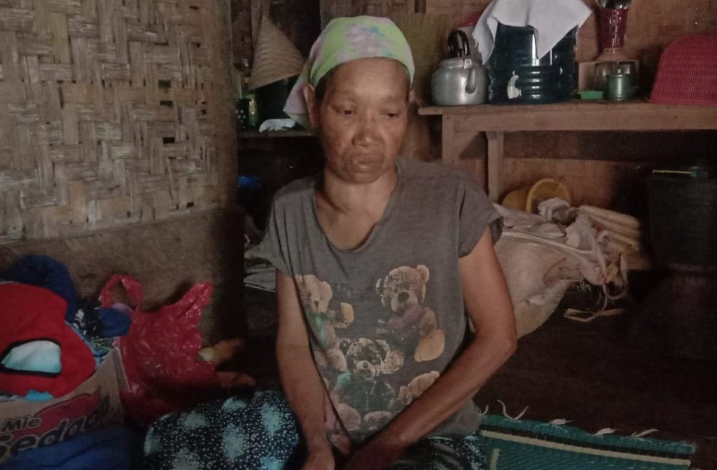 Sakit Kelenjar Dileher dengan Kondisi Memprihatinkan, Janda Tua di Naringgul Butuh Bantuan